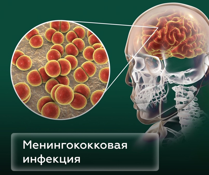 Менингококковая инфекция – это опасно!
